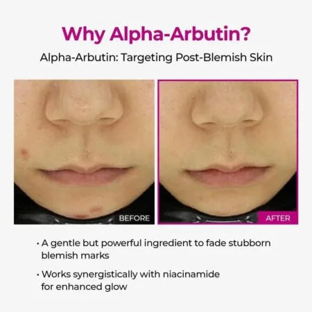 Dr.Melaxin Cemenrete Picotonic Shot