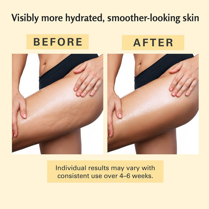 Anti Cellulite Massage Oil, Collagen + Stem Cell Infused
