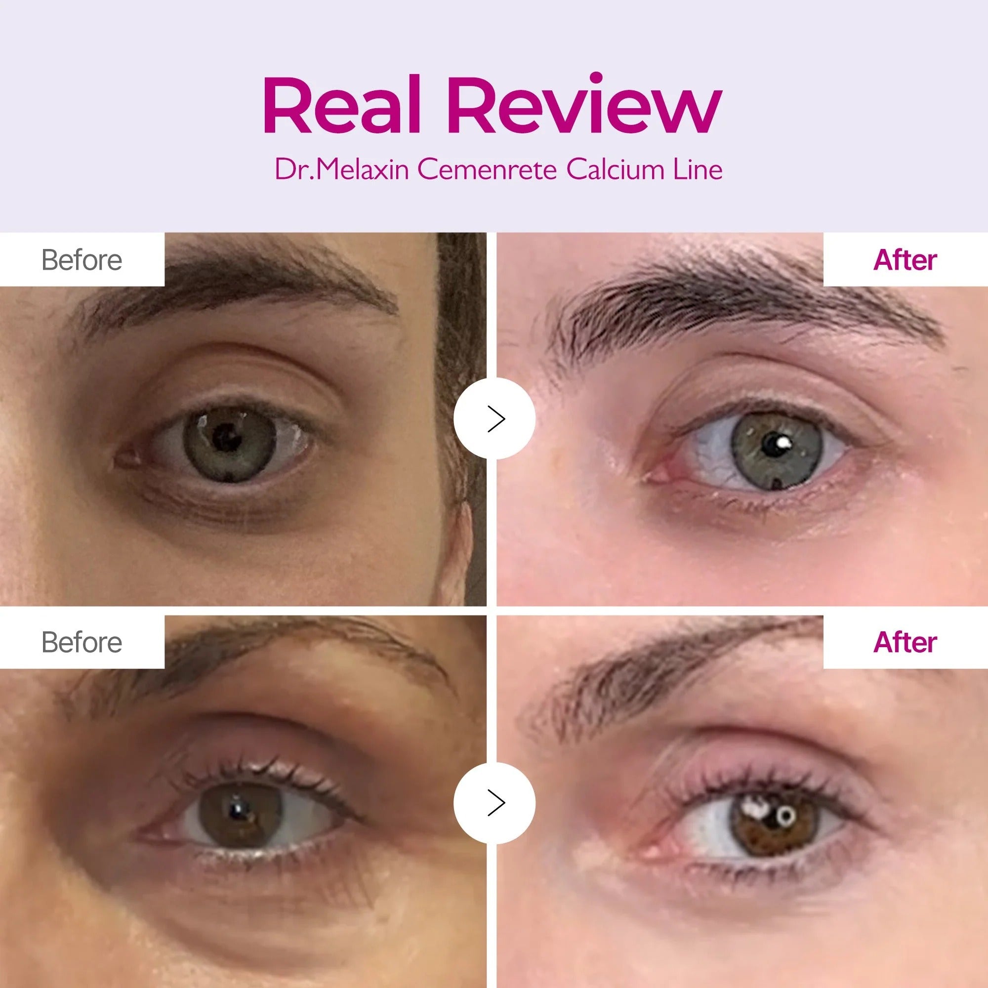 Dr.Melaxin Cemenrete Calcium Intense Cream