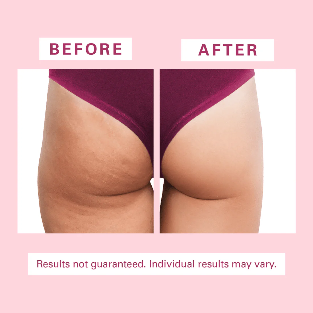 Anti Cellulite Silicon Body Brush