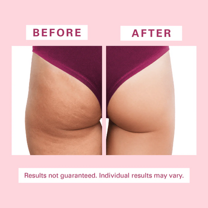 Anti Cellulite Silicon Body Brush